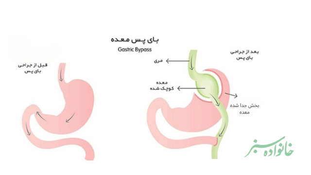 جدیدترین روش لاغری